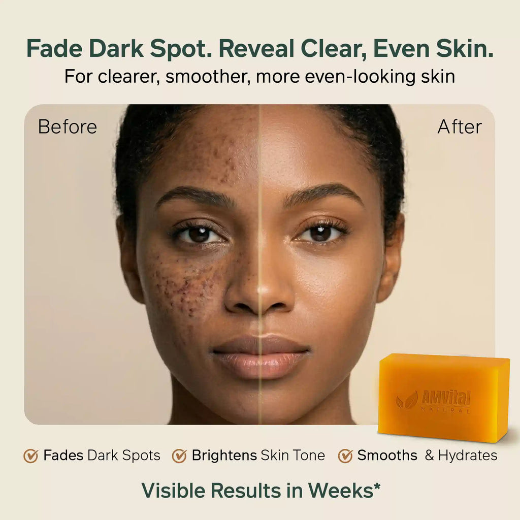 AMVital Turmeric Kojic Acid Soap Bar for Dark Spots & Uneven Tone